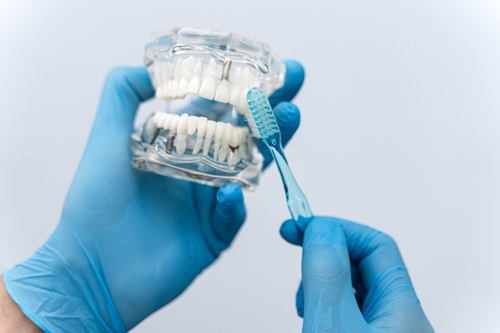 The Dentist In A Rubber Glove Shows On The Jaw How 2026 01 05 06 12 13 Utc 2