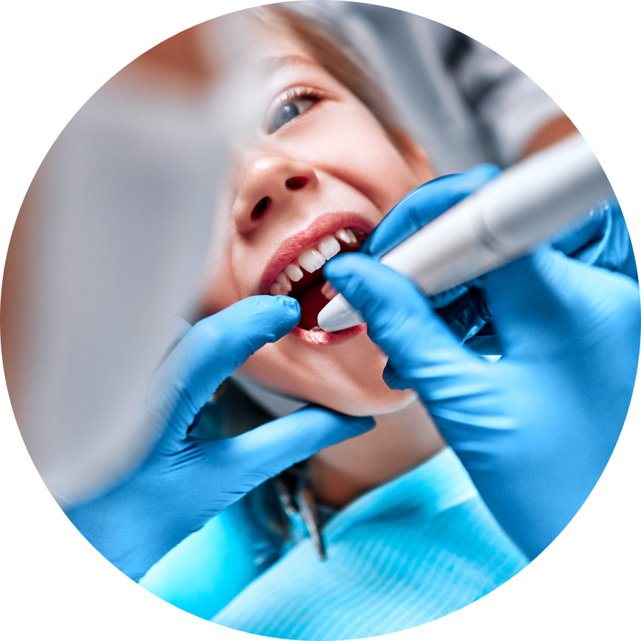 What Are Dental Fillings