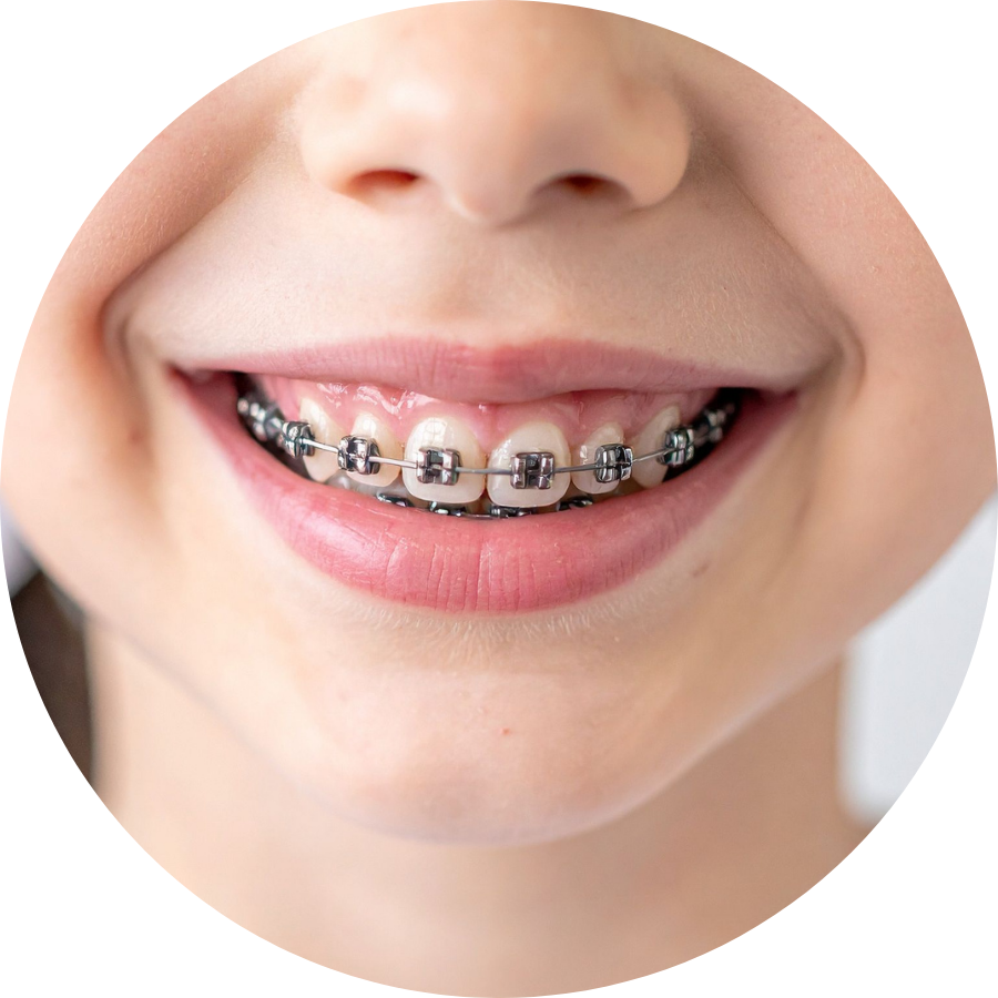 What Are Orthodontics