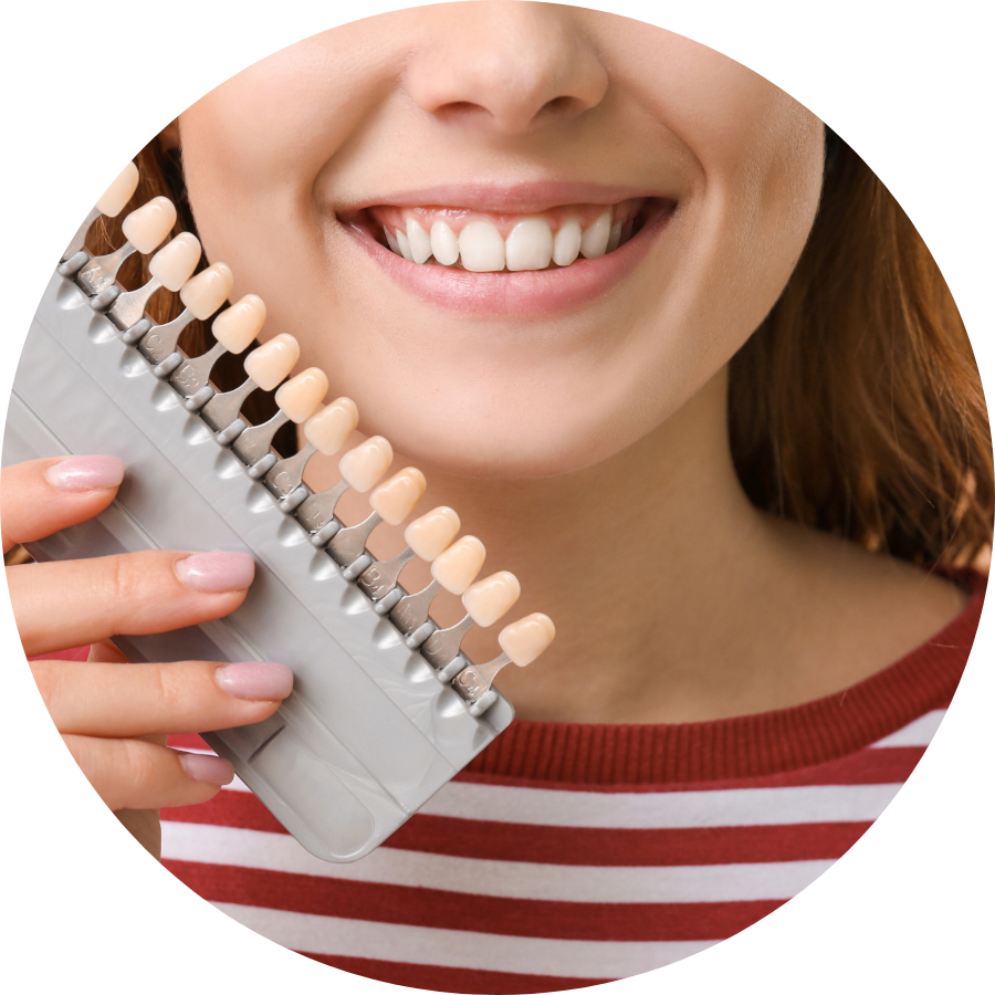 What Are Porcelain Veneers