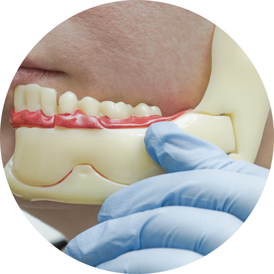 What Is Jaw Surgery