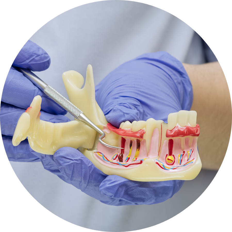What Is Periodontics