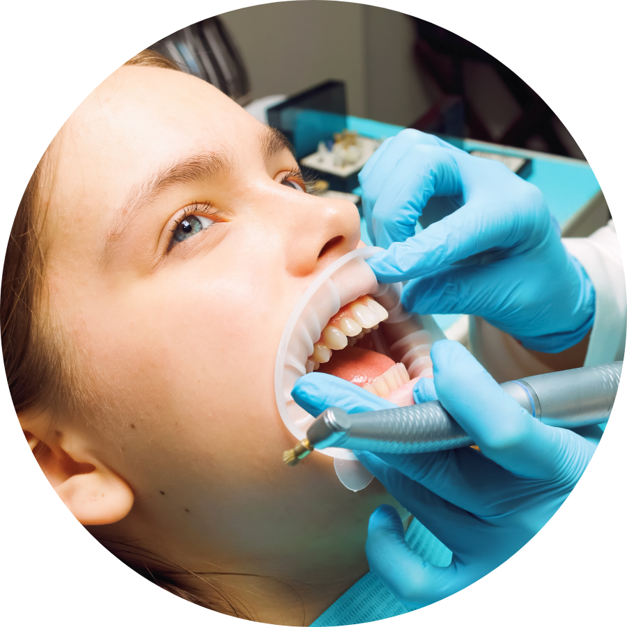 What Is Teeth Cleaning